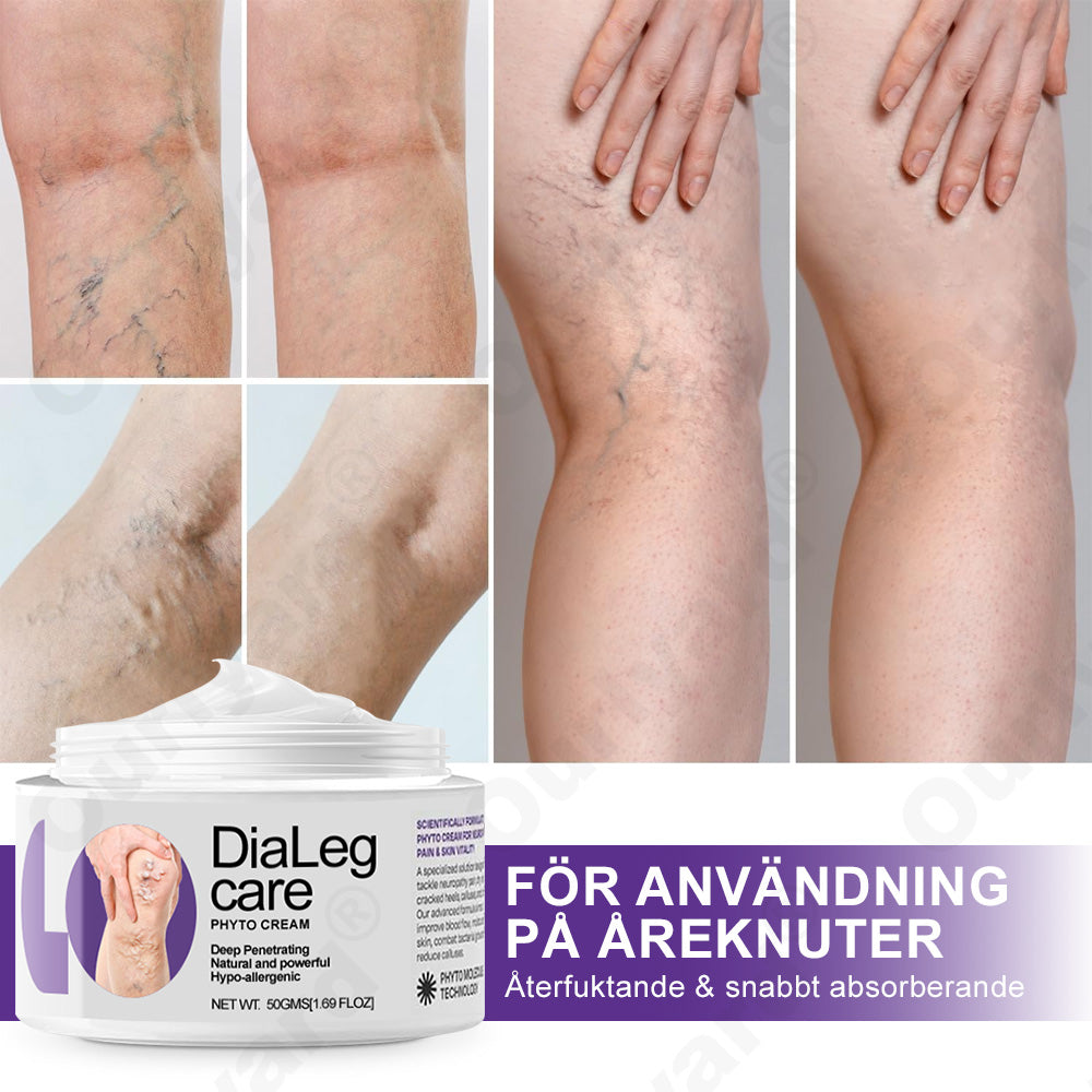 ✅𝐎𝐮𝐫𝐥𝐲𝐚𝐫𝐝® 𝐃𝐢𝐚𝐋𝐞𝐠 𝐂𝐚𝐫𝐞 𝐕𝐚̈𝐱𝐭𝐤𝐫𝐚̈𝐦 - Hjälper mot åderbråck, svullnad, kramp och bensmärta