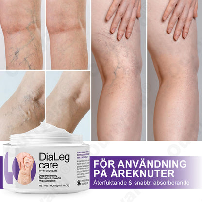 ✅𝐎𝐮𝐫𝐥𝐲𝐚𝐫𝐝® 𝐃𝐢𝐚𝐋𝐞𝐠 𝐂𝐚𝐫𝐞 𝐕𝐚̈𝐱𝐭𝐤𝐫𝐚̈𝐦 - Hjälper mot åderbråck, svullnad, kramp och bensmärta