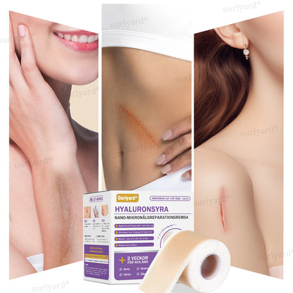 ✅Officiell butik | Ourlyard® Hyaluronsyra Nano Microneedle Repair Tape🏥(Behandling av gamla och nya ärr, minskning av kirurgiska ärr, bristningar, keloider, akne, brännskador, vårtor, dermatomer och åderbråck)