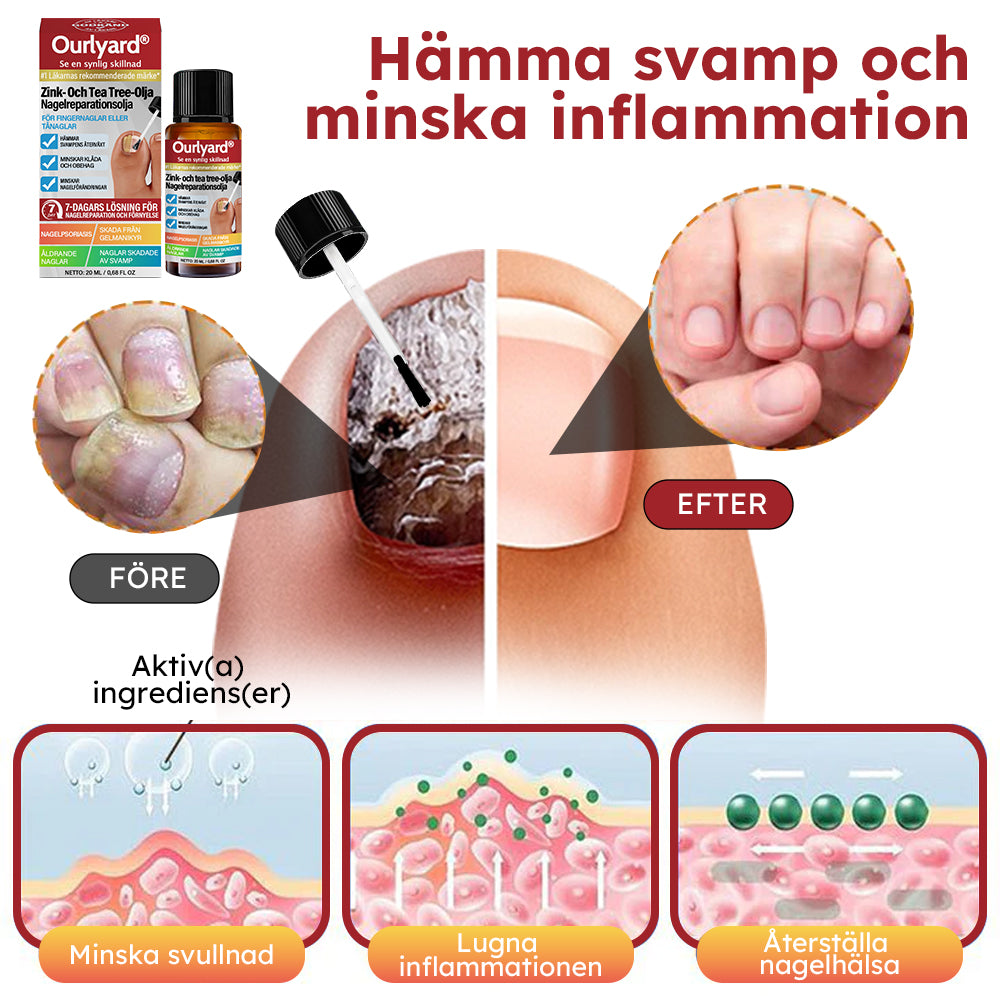 ✅ Tillverkad och skickad från Sverige | Ourlyard® Zink- Och Tea Tree Olja Nagelreparationsolja (Omfattande reparation, kraftfull behandling för alla nagelbesvär) 🍀