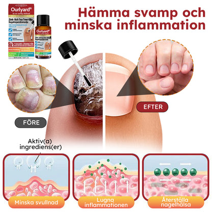 ✅ Tillverkad och skickad från Sverige | Ourlyard® Zink- Och Tea Tree Olja Nagelreparationsolja (Omfattande reparation, kraftfull behandling för alla nagelbesvär) 🍀