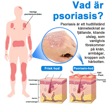 ✅Officiell butik: Zvoevo® Magnesium Herbal Psoriasis Spray ChatGPT said: (Lindrar psoriasis och eksem, förbättrar bakteriella infektioner i genitalområdet, behandlar akne och vårtor, lindrar ledvärk och neuropatisk smärta)
