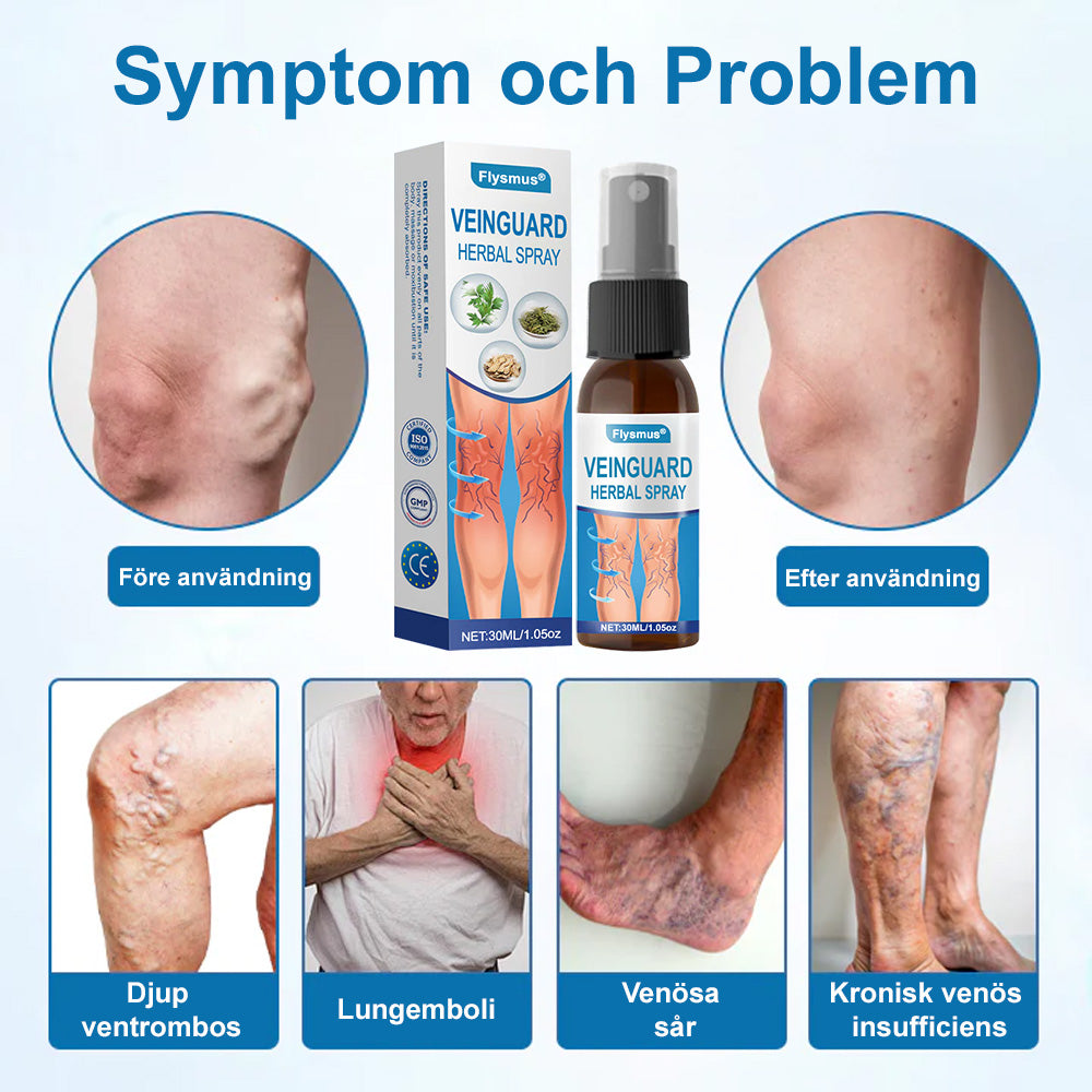 🏔️🌿𝐅𝐥𝐲𝐬𝐦𝐮𝐬® 𝐕𝐞𝐢𝐧𝐆𝐮𝐚𝐫𝐝 𝐇𝐞𝐫𝐛𝐚𝐥 𝐒𝐩𝐫𝐚𝐲 – För friska, smärtfria ben