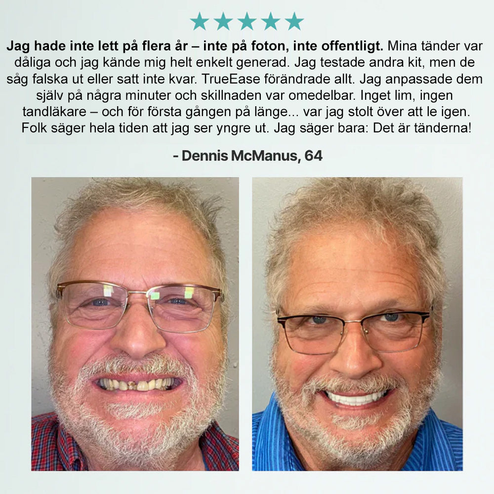 🦷𝗕𝗶𝗸𝗲𝗻𝗱𝗮®🦷 𝗔𝗱𝘃𝗮𝗻𝗰𝗲𝗱 𝗞𝗹𝗮𝗱𝗱𝗳𝗿𝗲𝗱𝗶𝗴 𝗙𝘂𝗹𝗹𝗮 𝗧𝗲𝗻𝗱𝗲𝗻𝘁𝗮𝗿 𝗦𝗲𝘁 （✅ Kliniskt beprövade bekväma proteser ）