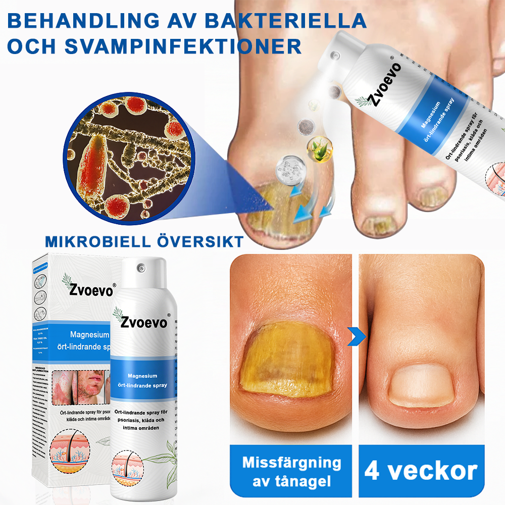 ✅Officiell butik: Zvoevo® Magnesium Herbal Psoriasis Spray ChatGPT said: (Lindrar psoriasis och eksem, förbättrar bakteriella infektioner i genitalområdet, behandlar akne och vårtor, lindrar ledvärk och neuropatisk smärta)