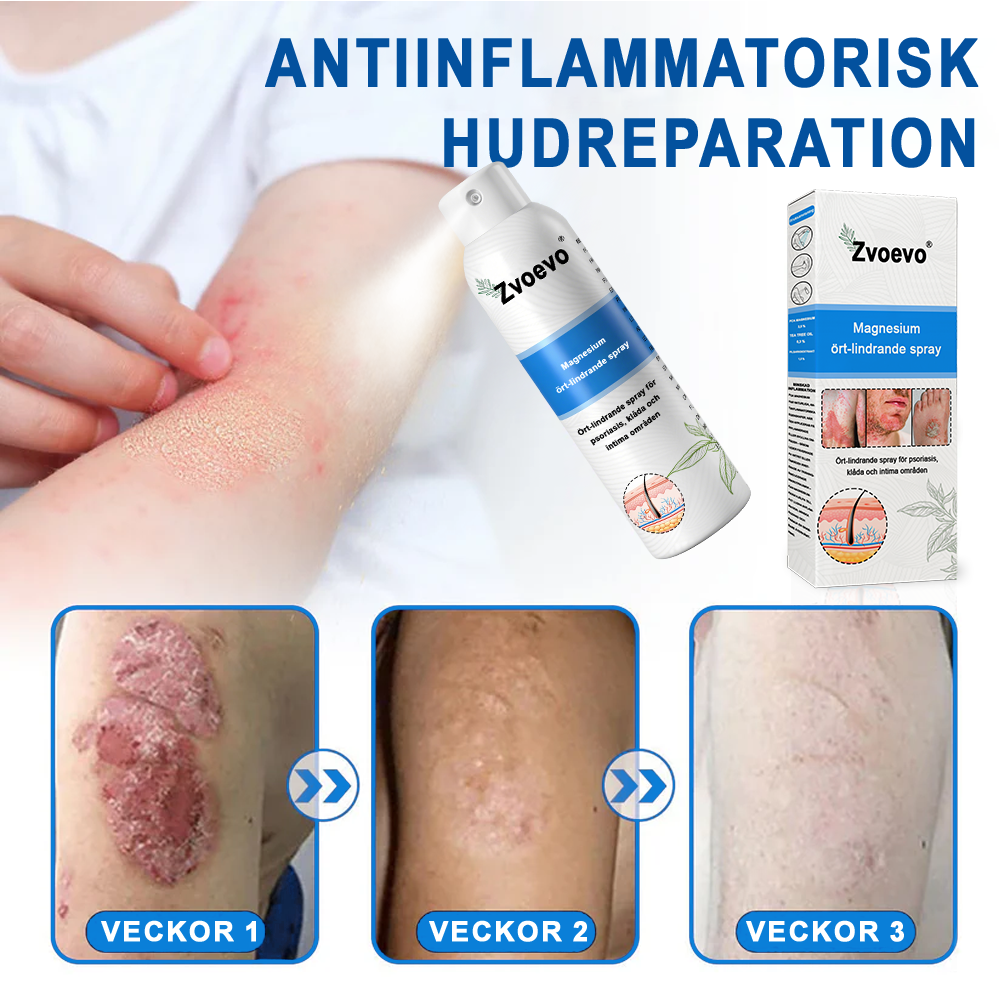 ✅Officiell butik: Zvoevo® Magnesium Herbal Psoriasis Spray ChatGPT said: (Lindrar psoriasis och eksem, förbättrar bakteriella infektioner i genitalområdet, behandlar akne och vårtor, lindrar ledvärk och neuropatisk smärta)