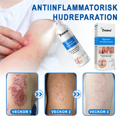✅Officiell butik: Zvoevo® Magnesium Herbal Psoriasis Spray ChatGPT said: (Lindrar psoriasis och eksem, förbättrar bakteriella infektioner i genitalområdet, behandlar akne och vårtor, lindrar ledvärk och neuropatisk smärta)