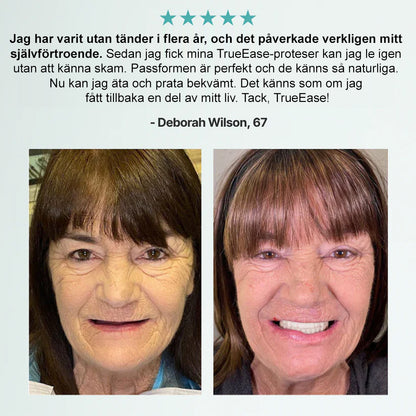 🦷𝗕𝗶𝗸𝗲𝗻𝗱𝗮®🦷 𝗔𝗱𝘃𝗮𝗻𝗰𝗲𝗱 𝗞𝗹𝗮𝗱𝗱𝗳𝗿𝗲𝗱𝗶𝗴 𝗙𝘂𝗹𝗹𝗮 𝗧𝗲𝗻𝗱𝗲𝗻𝘁𝗮𝗿 𝗦𝗲𝘁 （✅ Kliniskt beprövade bekväma proteser ）