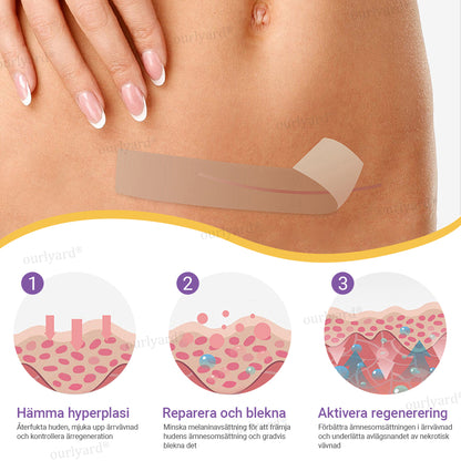 ✅Officiell butik | Ourlyard® Hyaluronsyra Nano Microneedle Repair Tape🏥(Behandling av gamla och nya ärr, minskning av kirurgiska ärr, bristningar, keloider, akne, brännskador, vårtor, dermatomer och åderbråck)