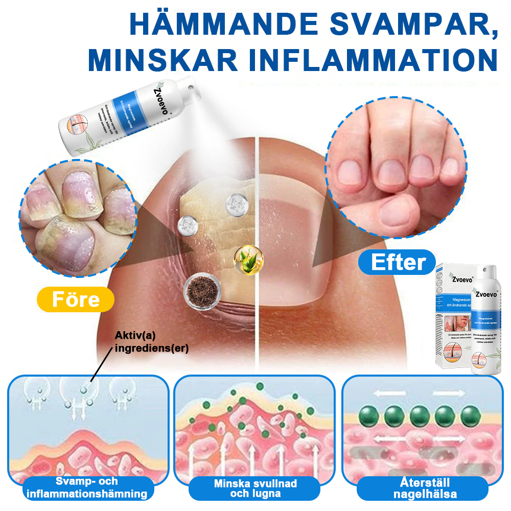 ✅Officiell butik: Zvoevo® Magnesium Herbal Psoriasis Spray ChatGPT said: (Lindrar psoriasis och eksem, förbättrar bakteriella infektioner i genitalområdet, behandlar akne och vårtor, lindrar ledvärk och neuropatisk smärta)